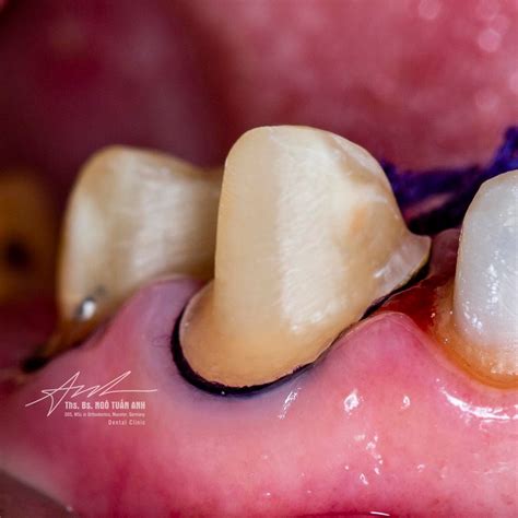 dds dr ngo tuan anh dds msc  orthodontics germany facebook