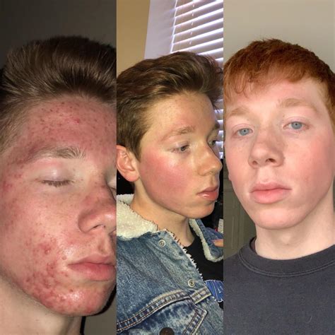 This Is What Happened Before, During, And After The Imacribaby Leak Image 3