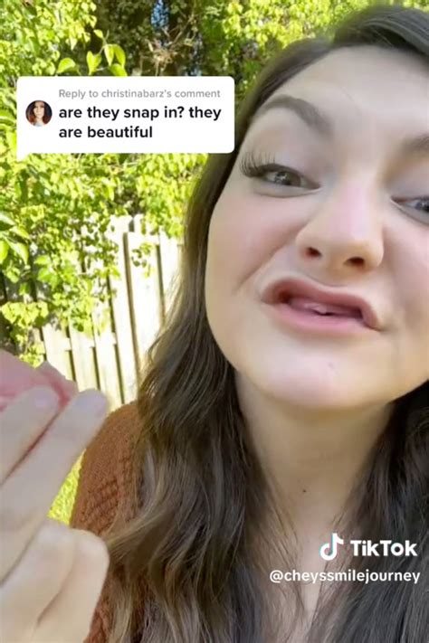 I'm a 'toothless babe' who needs dentures at 30 -- I'm raising funds