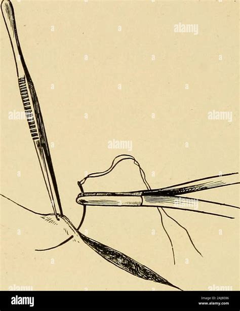 surgical assistant  manual  students practitioners hospital