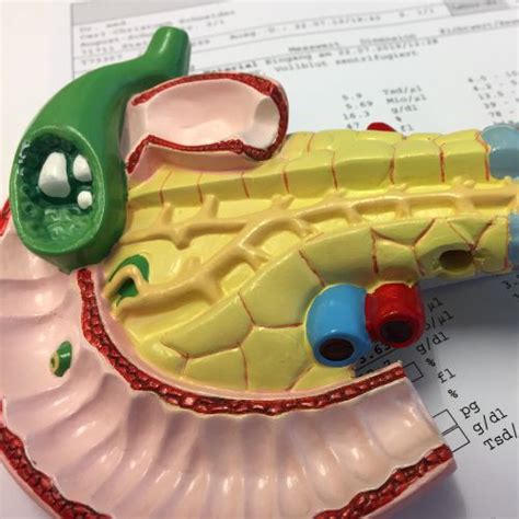 Gangrenous Gallbladder: Causes, Symptoms, Mortality Rate, & Treatment ...