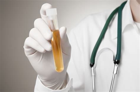 Dark Urine | Causes, What Does it Mean, What to Do, FAQs