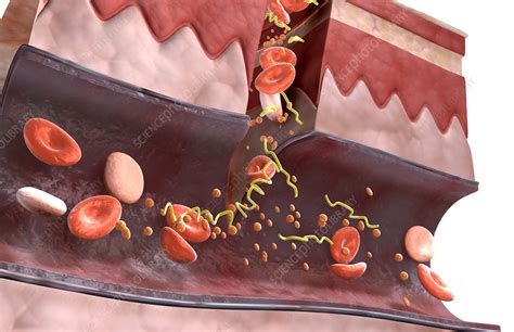 Blood Clot Formation Diagram