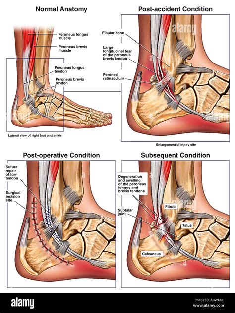 Medial Malleolus High Resolution Stock Photography and Images - Alamy