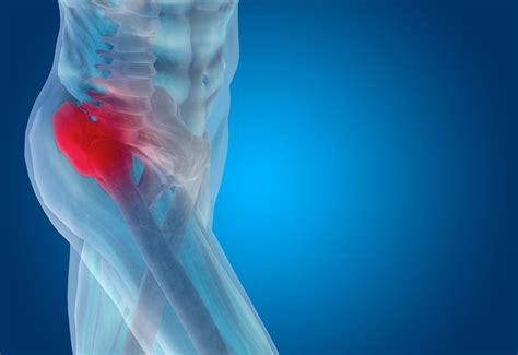 Hip Labrum Tear Treatment in Toronto - Physiomobility