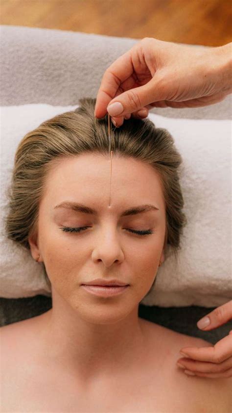 6 Acupuncture Pressure Points To Relieve Headaches And Migraines