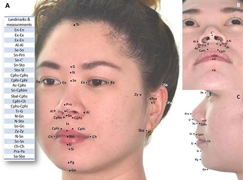 Evaluating the accuracy of facial models obtained from volume wrapping