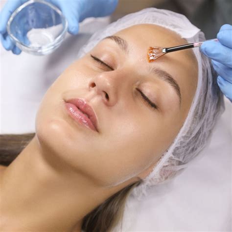 chemical peeling harga murah terjangkau klinik kecantikan magna