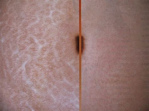 sweet gorgeous centre selulit