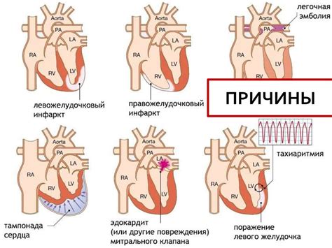 Кардиогенный шок - презентация онлайн