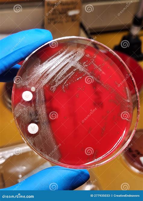 S Pneumoniae Bacteria 1