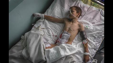 9-летний Владик увидел смерть своей мамы от украинского обстрела ...