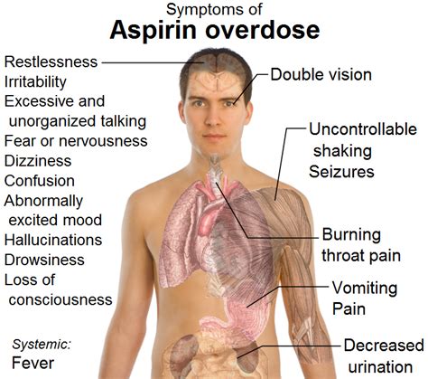 toxicity of salicylate and acetylsalicylate (aspirin) - Drug design, therapeutics and Toxicology