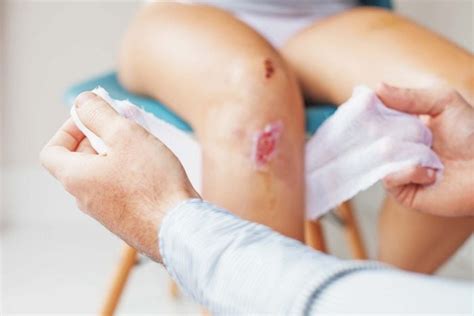 how to know if a knee scrape is infected
