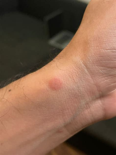 dermatologist   skin red bumps