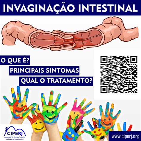 O Que É Invaginação - Invaginação Intestinal: O que é? O que fazer? – CIPERJ | Associação de ...