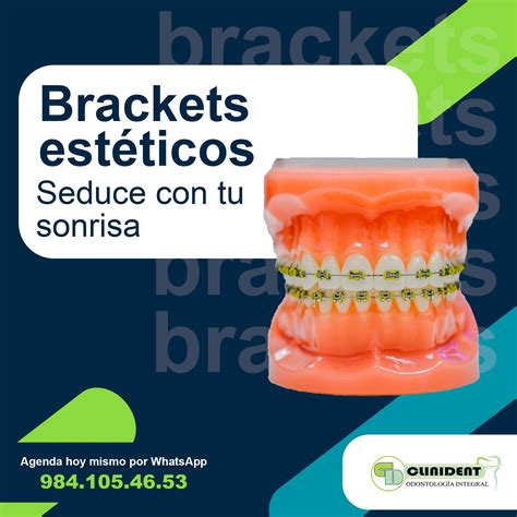 🌟 Mejora tu sonrisa con... - CLINIDENT- Odontología Integral | Facebook