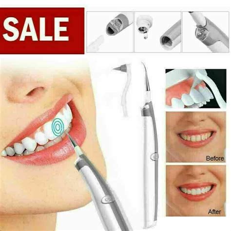 Уред за ултразвуково почистване на зъбна плака - WoW Gadgets Shop
