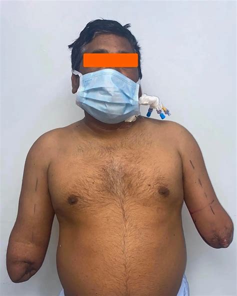 7 MyChart TVC Hacks That Will Blow Your Mind (Doctors Hate This!) Image 11
