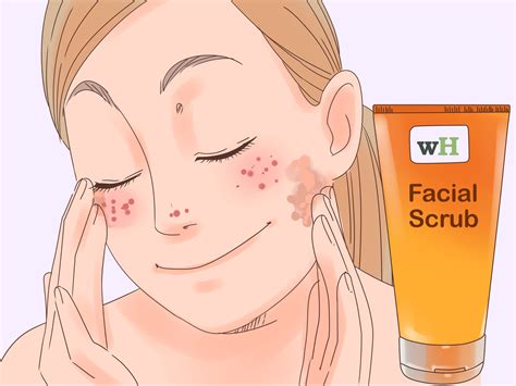 How To Get Rid Of Redness On Your Face Without Makeup - Mugeek Vidalondon