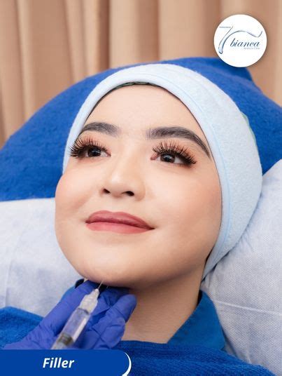 filler klinik kecantikan bianca