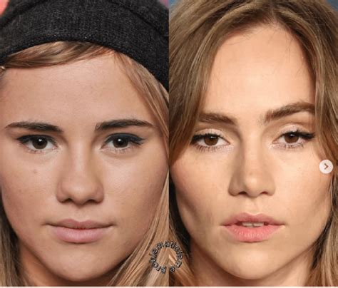 Rate Suki Waterhouse pre and post plastic surgery : r/VindictaRateCelebs