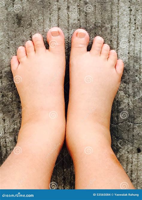how to help swollen feet during pregnancy 5