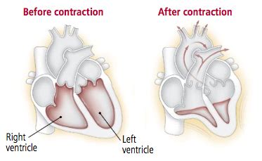 What is ejection fraction? | Virtual Heart Failure Clinic
