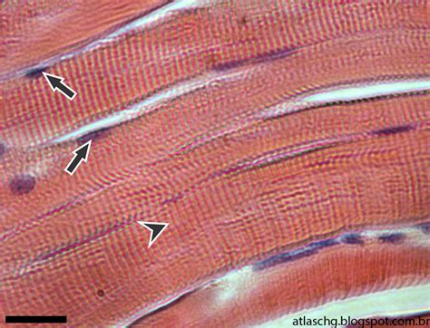 Tecido Muscular Estriado Esquelético - 8