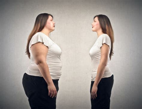 Obesity and varicose veins | how does weight affect varicose veins