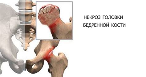 Болезни крестца: характерные симптомы и способы лечения
