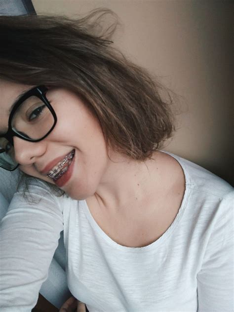 Braces with glasses girl – Artofit