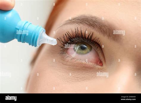 Woman with conjunctivitis using eye drops, closeup Stock Photo - Alamy