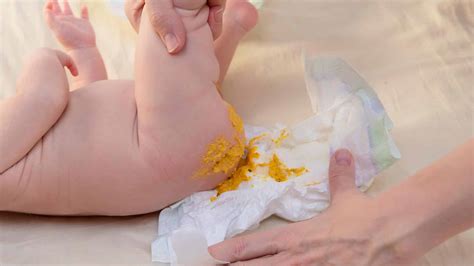 Fezes De Bebe Com Infecção Intestinal