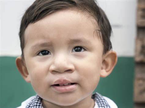 Peru | Operation Smile