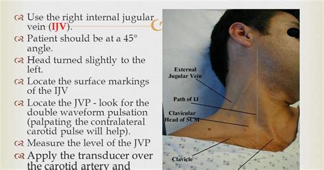 Histology Slides Database: Internal and external jugular vein surface ...
