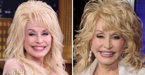 Dolly Parton Fans Blown Away As Star Reveals Her Real Hair After Years ...