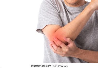 Sore Pain Elbow Sprain Arthritis Symptoms Stock Photo 1843402171 ...