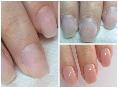 Ногти После Аппаратного Маникюра Фото — Richnail.ru