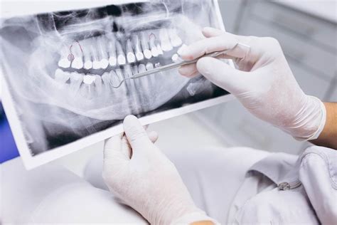 Ортопантомограмма (ОПТГ) зубов в Старом Осколе | Dental House