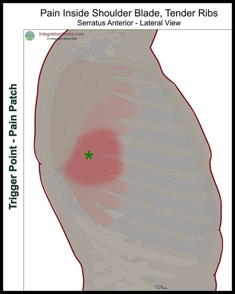 Nagging Pain Inside The Bottom of the Shoulder Blade - Integrative Works