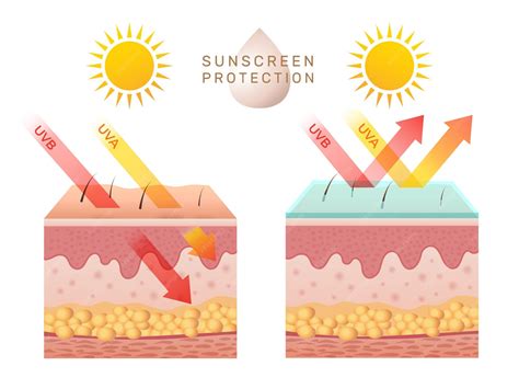 How Does Uv Cause Skin Cancer at Isabella Jolly blog
