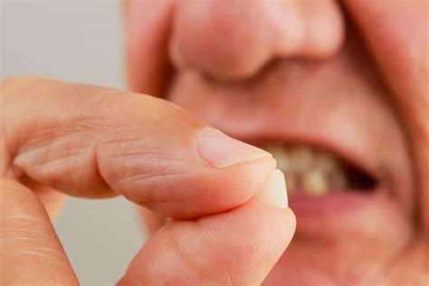 How to Fix a Chipped Tooth | Spearmint Dental & Orthodontics