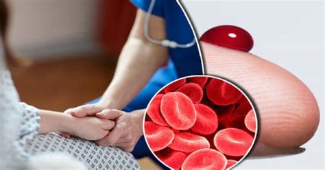Hemofilia: przyczyny, objawy i leczenie