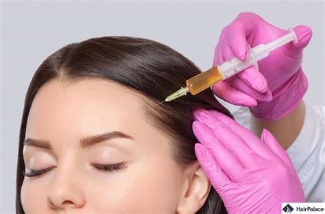 PRF Hair Treatment: Everything You Should Know in 2026