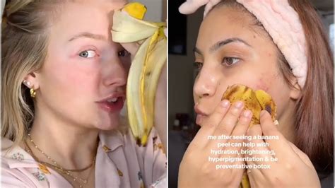 Experts debunk TikTok skincare trend using bananas as 'natural botox ...