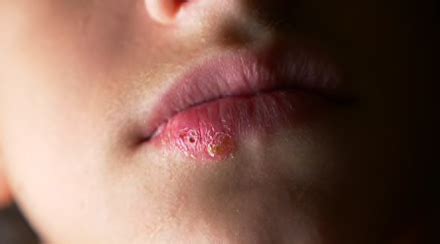 HERPES AND PERMANENT MAKEUP - Перманентный макияж