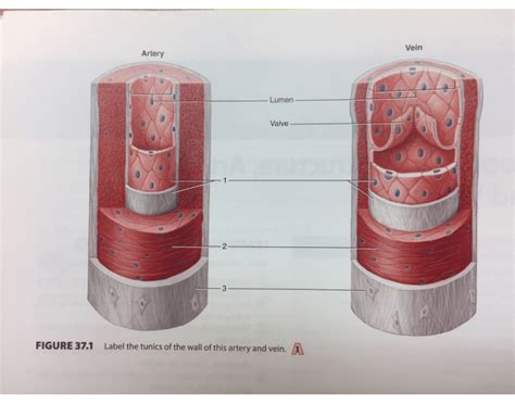 artery wall quiz