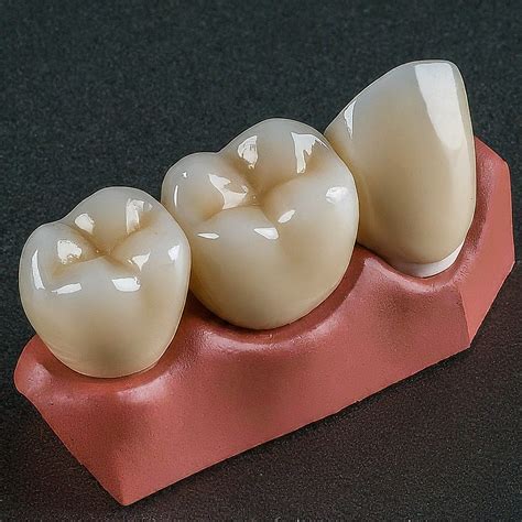 Zirconia Crowns: Easily Invest in a Smile that Lasts for 15+ Years