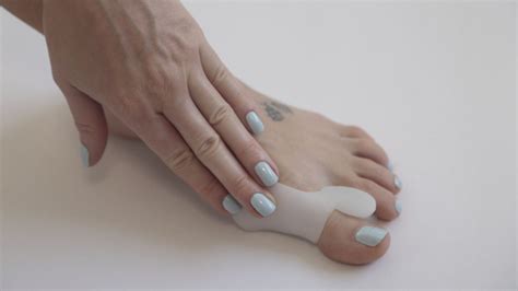 Top Proven Methods to Fix Bunions Naturally and Effectively - Hunter Games Magazine